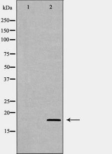 LY96 / MD2 / MD-2 Antibody - Western blot analysis of rat spleen lysate using LY96 antibody. The lane on the left is treated with the antigen-specific peptide.