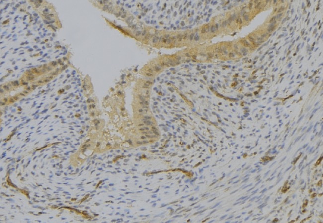 LY96 / MD2 / MD-2 Antibody - 1:100 staining human uterus tissue by IHC-P. The sample was formaldehyde fixed and a heat mediated antigen retrieval step in citrate buffer was performed. The sample was then blocked and incubated with the antibody for 1.5 hours at 22°C. An HRP conjugated goat anti-rabbit antibody was used as the secondary.