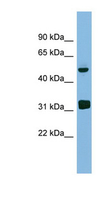LYAR Antibody - LYAR antibody Western blot of Fetal Heart lysate. This image was taken for the unconjugated form of this product. Other forms have not been tested.