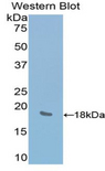 LYAR Antibody - Western blot of recombinant LYAR.  This image was taken for the unconjugated form of this product. Other forms have not been tested.
