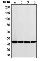 LYAR Antibody - Western blot analysis of LYAR expression in K562 (A); Ramos (B); HeLa (C); A431 (D) whole cell lysates.