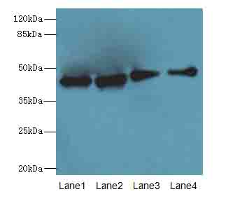 LYAR Antibody - Western blot. All lanes: LYAR antibody at 5 ug/ml. Lane 1: A431 whole cell lysate. Lane 2: K562 whole cell lysate. Lane 3: HeLa whole cell lysate. Lane 4: Jurkat whole cell lysate. Secondary Goat polyclonal to Rabbit IgG at 1:10000 dilution. Predicted band size: 44 kDa. Observed band size: 44 kDa.