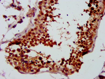 LYAR Antibody - IHC image of LYAR Antibody diluted at 1:500 and staining in paraffin-embedded human testis tissue performed on a Leica BondTM system. After dewaxing and hydration, antigen retrieval was mediated by high pressure in a citrate buffer (pH 6.0). Section was blocked with 10% normal goat serum 30min at RT. Then primary antibody (1% BSA) was incubated at 4°C overnight. The primary is detected by a biotinylated secondary antibody and visualized using an HRP conjugated SP system.