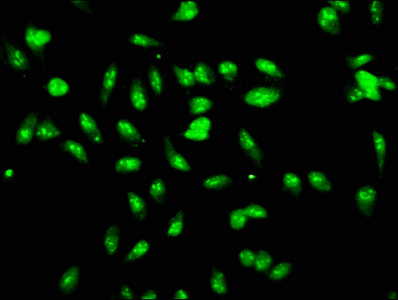 LYAR Antibody - Immunofluorescence staining of Hela cells with LYAR Antibody at 1:166, counter-stained with DAPI. The cells were fixed in 4% formaldehyde, permeabilized using 0.2% Triton X-100 and blocked in 10% normal Goat Serum. The cells were then incubated with the antibody overnight at 4°C. The secondary antibody was Alexa Fluor 488-congugated AffiniPure Goat Anti-Rabbit IgG(H+L).