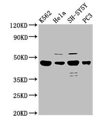 LYAR Antibody - Western Blot Positive WB detected in: K562 whole cell lysate, Hela whole cell lysate, SH-SY5Y whole cell lysate, PC-3 whole cell lysate All lanes: LYAR antibody at 2.5µg/ml Secondary Goat polyclonal to rabbit IgG at 1/50000 dilution Predicted band size: 44 kDa Observed band size: 44 kDa