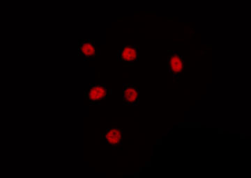 LYAR Antibody - Staining HepG2 cells by IF/ICC. The samples were fixed with PFA and permeabilized in 0.1% Triton X-100, then blocked in 10% serum for 45 min at 25°C. The primary antibody was diluted at 1:200 and incubated with the sample for 1 hour at 37°C. An Alexa Fluor 594 conjugated goat anti-rabbit IgG (H+L) Ab, diluted at 1/600, was used as the secondary antibody.