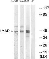 LYAR Antibody - Western blot analysis of extracts from LOVO cells, HepG2 cells and Jurkat cells, using LYAR antibody.