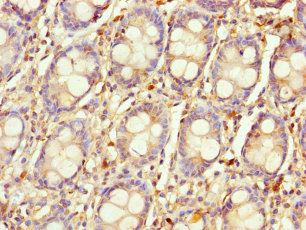 LYG1 Antibody - Immunohistochemistry of paraffin-embedded human colon tissue using LYG1 Antibody at dilution of 1:100