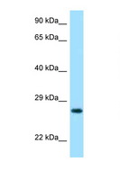 LYG2 Antibody - LYG2 antibody Western blot of 435S Cell lysate. Antibody concentration 1 ug/ml.  This image was taken for the unconjugated form of this product. Other forms have not been tested.