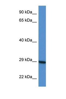 LYG2 Antibody - LYG2 antibody Western blot of HepG2 Cell lysate. Antibody concentration 1 ug/ml.  This image was taken for the unconjugated form of this product. Other forms have not been tested.