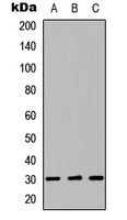 LYL1 Antibody - Western blot analysis of LYL1 expression in HEK293T (A); Raw264.7 (B); H9C2 (C) whole cell lysates.