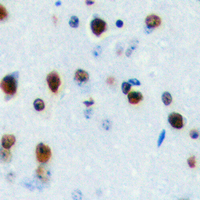 LYL1 Antibody - Immunohistochemical analysis of LYL1 staining in human brain formalin fixed paraffin embedded tissue section. The section was pre-treated using heat mediated antigen retrieval with sodium citrate buffer (pH 6.0). The section was then incubated with the antibody at room temperature and detected using an HRP conjugated compact polymer system. DAB was used as the chromogen. The section was then counterstained with hematoxylin and mounted with DPX.