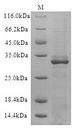 GPC Protein - (Tris-Glycine gel) Discontinuous SDS-PAGE (reduced) with 5% enrichment gel and 15% separation gel.