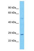 Lymphotoxin-Beta / LTB Antibody - Lymphotoxin-Beta / LTB antibody Western Blot of Colorectal Tumor. Antibody dilution: 1 ug/ml.  This image was taken for the unconjugated form of this product. Other forms have not been tested.
