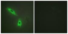 Lymphotoxin-Beta / LTB Antibody - Immunofluorescence analysis of HeLa cells, using TNFC Antibody. The picture on the right is blocked with the synthesized peptide.