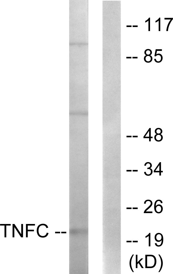 Lymphotoxin-Beta / LTB Antibody - Western blot analysis of lysates from HepG2 cells, using TNFC Antibody. The lane on the right is blocked with the synthesized peptide.