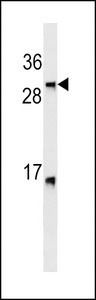 Lymphotoxin-Beta / LTB Antibody - LTB Antibody western blot of HL-60 cell line lysates (35 ug/lane). The LTB antibody detected the LTB protein (arrow).