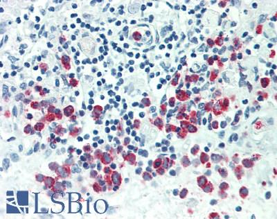 Lymphotoxin-Beta / LTB Antibody - Human Thymus: Formalin-Fixed, Paraffin-Embedded (FFPE)