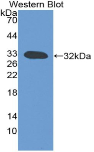 Lymphotoxin-Beta / LTB Antibody - Western blot of recombinant Lymphotoxin-Beta / LTB.  This image was taken for the unconjugated form of this product. Other forms have not been tested.