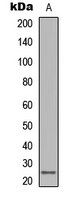 Lymphotoxin-Beta / LTB Antibody - Western blot analysis of LT beta expression in human lymph node (A) whole cell lysates.