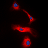 Lymphotoxin-Beta / LTB Antibody - Immunofluorescent analysis of LT beta staining in HeLa cells. Formalin-fixed cells were permeabilized with 0.1% Triton X-100 in TBS for 5-10 minutes and blocked with 3% BSA-PBS for 30 minutes at room temperature. Cells were probed with the primary antibody in 3% BSA-PBS and incubated overnight at 4 deg C in a humidified chamber. Cells were washed with PBST and incubated with a DyLight 594-conjugated secondary antibody (red) in PBS at room temperature in the dark. DAPI was used to stain the cell nuclei (blue).