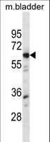 LYN Antibody - Mouse Lyn Antibody western blot of mouse bladder tissue lysates (35 ug/lane). The Lyn antibody detected the Lyn protein (arrow).