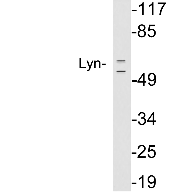 LYN Antibody - Western blot analysis of lysates from HeLa cells, using Lyn antibody.