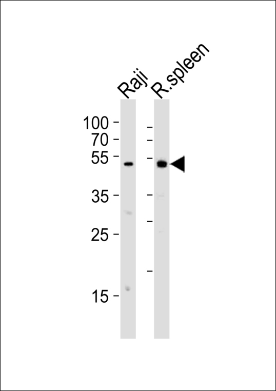 LYN Antibody - Western blot of lysates from Raji cell line and rat spleen tissue lysate (from left to right) with Mouse Lyn Antibody. Antibody was diluted at 1:1000 at each lane. A goat anti-rabbit IgG H&L (HRP) at 1:5000 dilution was used as the secondary antibody. Lysates at 35 ug per lane.