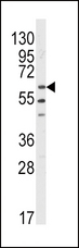 LYN Antibody - Western blot of anti-LYN Antibody in HL60 cell line lysates (35 ug/lane). LYN (arrow) was detected using the purified antibody.