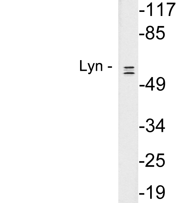 LYN Antibody - Western blot analysis of lysates from K562 cells, using Lyn antibody.