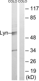LYN Antibody - Western blot analysis of lysates from COLO cells, treated with H2O2 100uM 30', using Lyn Antibody. The lane on the right is blocked with the synthesized peptide.