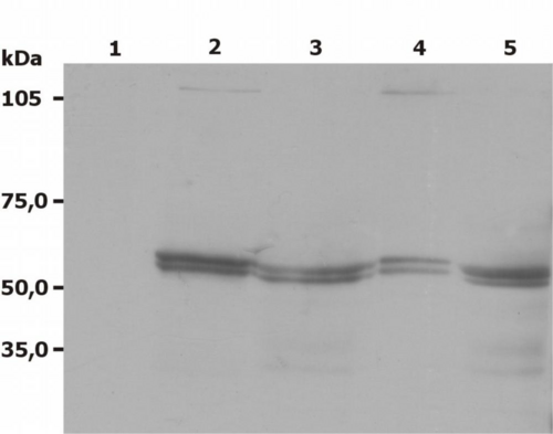 LYN Antibody - Western Blotting analysis (non-reducing conditions) of Lyn using anti-Lyn (LYN-01).  Lane 1: negative control  Lane 2: RBL rat basophilic leukemia cell line  Lane 3: JURKAT human peripheral blood T cell leukemia cell line  Lane 4: A-431 human epidermoid carcinoma cell line  Lane 5: U-937 human histiocytic lymphoma cell line