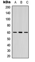LYN Antibody - Western blot analysis of LYN (pY397) expression in Jurkat (A); human spleen (B); mouse lung (C) whole cell lysates.