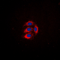 LYN Antibody - Immunofluorescent analysis of LYN staining in HeLa cells. Formalin-fixed cells were permeabilized with 0.1% Triton X-100 in TBS for 5-10 minutes and blocked with 3% BSA-PBS for 30 minutes at room temperature. Cells were probed with the primary antibody in 3% BSA-PBS and incubated overnight at 4 deg C in a humidified chamber. Cells were washed with PBST and incubated with a DyLight 594-conjugated secondary antibody (red) in PBS at room temperature in the dark. DAPI was used to stain the cell nuclei (blue).