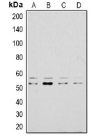 LYN Antibody - Western blot analysis of LYN expression in A431 (A); HeLa (B); mouse kidney (C); PC12 (D) whole cell lysates.