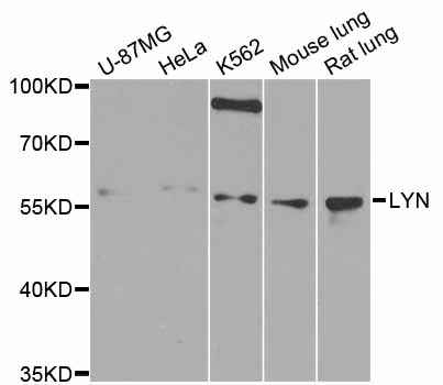 LYN Antibody - Western blot analysis of extracts of various cell lines.