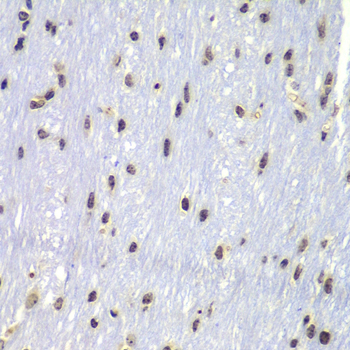 LYN Antibody - Immunohistochemistry of paraffin-embedded mouse brain tissue.
