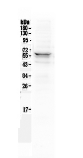 LYN Antibody - Western blot analysis of Lyn using anti-Lyn antibody. Electrophoresis was performed on a 5-20% SDS-PAGE gel at 70V (Stacking gel) / 90V (Resolving gel) for 2-3 hours. The sample well of each lane was loaded with 50ug of sample under reducing conditions. Lane 1: human 293T whole cell lysate. After Electrophoresis, proteins were transferred to a Nitrocellulose membrane at 150mA for 50-90 minutes. Blocked the membrane with 5% Non-fat Milk/ TBS for 1.5 hour at RT. The membrane was incubated with rabbit anti-Lyn antigen affinity purified polyclonal antibody at 0.5 µg/mL overnight at 4°C, then washed with TBS-0.1% Tween 3 times with 5 minutes each and probed with a goat anti-rabbit IgG-HRP secondary antibody at a dilution of 1:10000 for 1.5 hour at RT. The signal is developed using an Enhanced Chemiluminescent detection (ECL) kit with Tanon 5200 system. A specific band was detected for Lyn at approximately 59KD. The expected band size for Lyn is at 59KD.