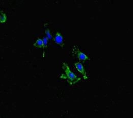 LYN Antibody - Immunofluorescent analysis of HeLa cells diluted at 1:100 and Alexa Fluor 488-congugated AffiniPure Goat Anti-Rabbit IgG(H+L)