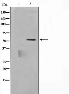 LYN Antibody - Western blot analysis of Lyn expression in H2O2 treated K562 whole cells lysates. The lane on the left is treated with the antigen-specific peptide.