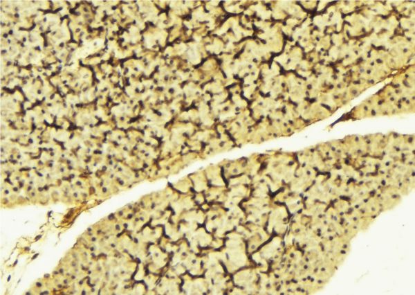 LYN Antibody - 1:100 staining mouse liver tissue by IHC-P. The sample was formaldehyde fixed and a heat mediated antigen retrieval step in citrate buffer was performed. The sample was then blocked and incubated with the antibody for 1.5 hours at 22°C. An HRP conjugated goat anti-rabbit antibody was used as the secondary.