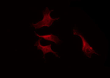 LYN Antibody - Staining K562 cells by IF/ICC. The samples were fixed with PFA and permeabilized in 0.1% Triton X-100, then blocked in 10% serum for 45 min at 25°C. The primary antibody was diluted at 1:200 and incubated with the sample for 1 hour at 37°C. An Alexa Fluor 594 conjugated goat anti-rabbit IgG (H+L) Ab, diluted at 1/600, was used as the secondary antibody.