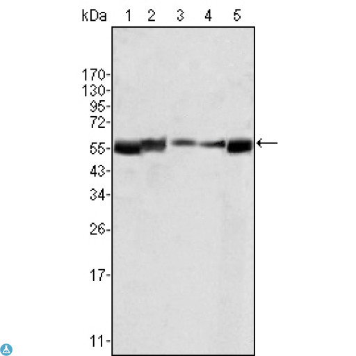LYN Antibody - Western Blot (WB) analysis using Lyn Monoclonal Antibody agains HL60 (1), L540 (2), SLLP-M2 (3), SEM (4) and Ramos (5) cell lysate.