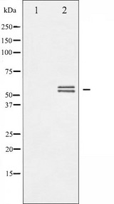 LYN Antibody - Western blot analysis of Lyn phosphorylation expression in H2O2 treated K562 whole cells lysates. The lane on the left is treated with the antigen-specific peptide.