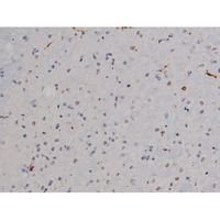 LYN Antibody - 1:200 staining mouse brain tissue by IHC-P. The tissue was formaldehyde fixed and a heat mediated antigen retrieval step in citrate buffer was performed. The tissue was then blocked and incubated with the antibody for 1.5 hours at 22°C. An HRP conjugated goat anti-rabbit antibody was used as the secondary.