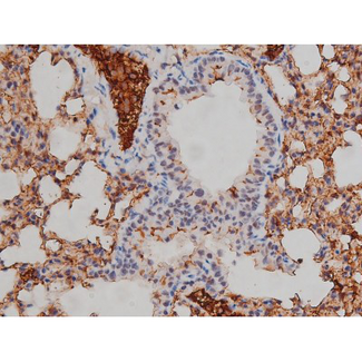 LYN Antibody - 1:200 staining mouse brain tissue by IHC-P. The tissue was formaldehyde fixed and a heat mediated antigen retrieval step in citrate buffer was performed. The tissue was then blocked and incubated with the antibody for 1.5 hours at 22°C. An HRP conjugated goat anti-rabbit antibody was used as the secondary.