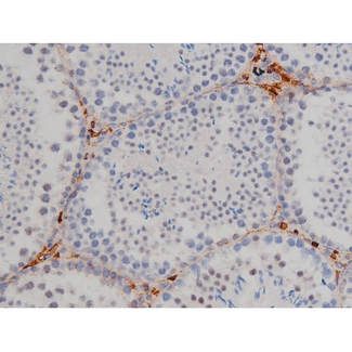 LYN Antibody - 1:200 staining mouse testis tissue by IHC-P. The tissue was formaldehyde fixed and a heat mediated antigen retrieval step in citrate buffer was performed. The tissue was then blocked and incubated with the antibody for 1.5 hours at 22°C. An HRP conjugated goat anti-rabbit antibody was used as the secondary.