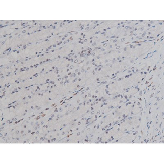 LYN Antibody - 1:200 staining rat ganstric tissue by IHC-P. The tissue was formaldehyde fixed and a heat mediated antigen retrieval step in citrate buffer was performed. The tissue was then blocked and incubated with the antibody for 1.5 hours at 22°C. An HRP conjugated goat anti-rabbit antibody was used as the secondary.