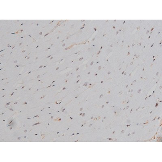LYN Antibody - 1:200 staining rat heart tissue by IHC-P. The tissue was formaldehyde fixed and a heat mediated antigen retrieval step in citrate buffer was performed. The tissue was then blocked and incubated with the antibody for 1.5 hours at 22°C. An HRP conjugated goat anti-rabbit antibody was used as the secondary.