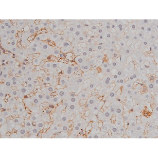 LYN Antibody - 1:200 staining rat liver tissue by IHC-P. The tissue was formaldehyde fixed and a heat mediated antigen retrieval step in citrate buffer was performed. The tissue was then blocked and incubated with the antibody for 1.5 hours at 22°C. An HRP conjugated goat anti-rabbit antibody was used as the secondary.